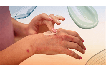 "بیماری پسوریازیس" را بیشتر بشناسیم