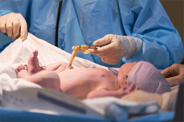 به بهانه روز جهانی خون بندناف؛ یک قطره زندگی، میلیون‌ها فرصت